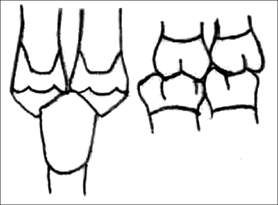 thumb